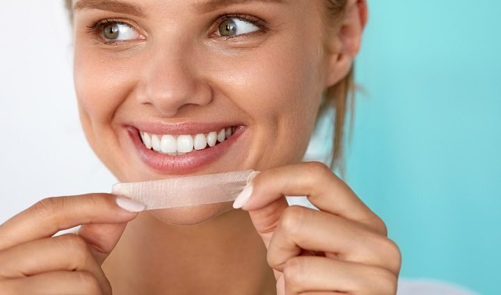 Teeth whitening at home