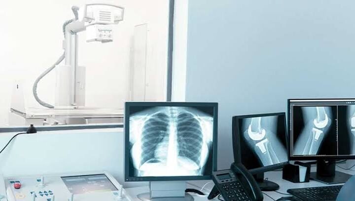 x ray film