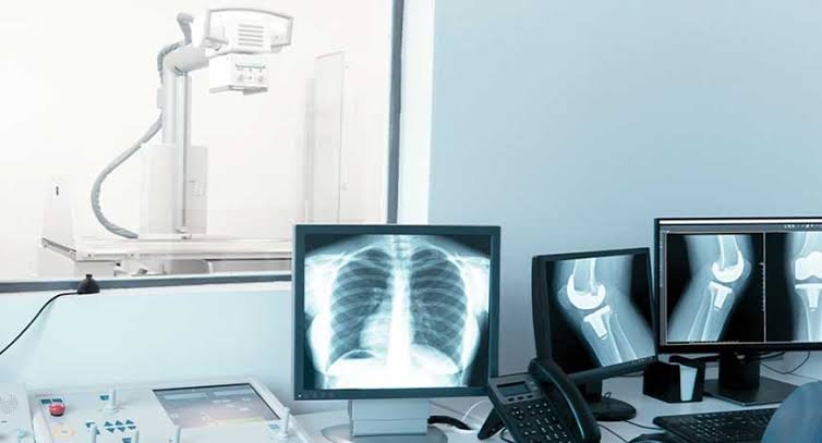 x ray film